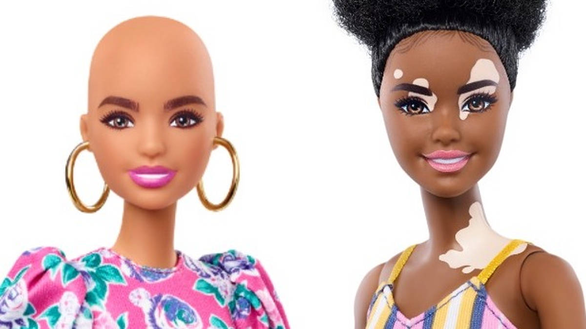 Mattel launch new Barbie dolls with vitiligo and hair loss | LBC