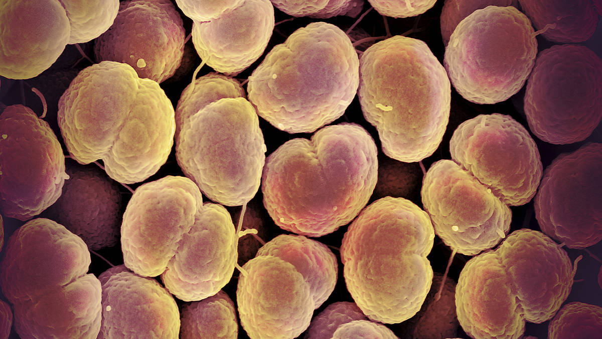 Record levels of gonorrhoea and syphilis recorded in Europe as worst ...